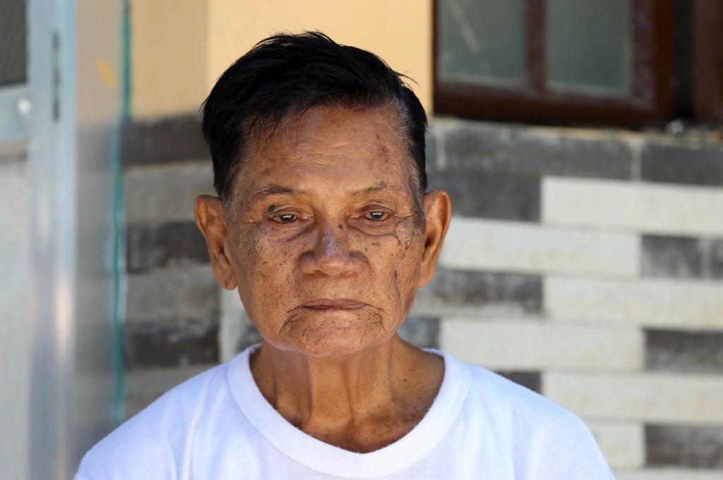 World War II veteran Pedro Santos Gutierrez, 87 years old. Born October 19, 1927. He voluntarily joined guerilla forces in 1942. Recalls an encounter with Japanese forces where one of the soldiers threw a grenade at his group, shrapnel hitting his face and limbs.  INQUIRER PHOTO/LYN RILLON