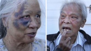Jamie and Paz Nagal, both 90, show serious bruising and a lost tooth, after a man and woman beat them during the second of two visits to the couple's home.