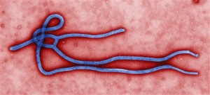 This undated file image made available by the Centers for Disease Control (CDC) shows the Ebola virus. The Manila International Airport Authority (MIAA) will be acquiring 40 protective suits for its personnel to use in the event that a person infected with the Ebola virus reaches Philippine soil.  AP PHOTO/CENTERS FOR DISEASE CONTROL