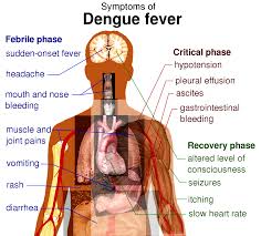 Symptoms of the dengue fever (INQUIRER FILE PHOTO)