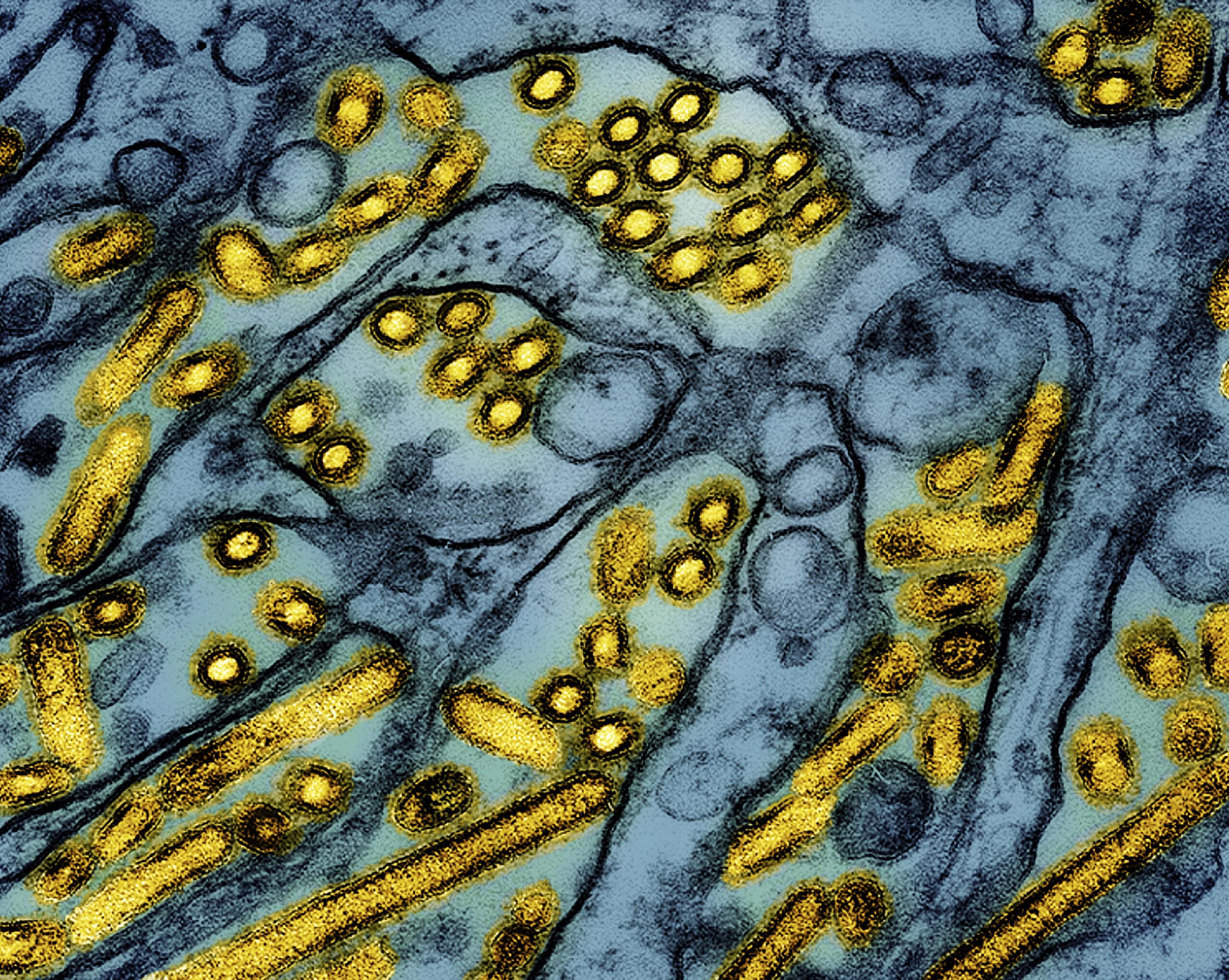 California declares emergency over bird flu